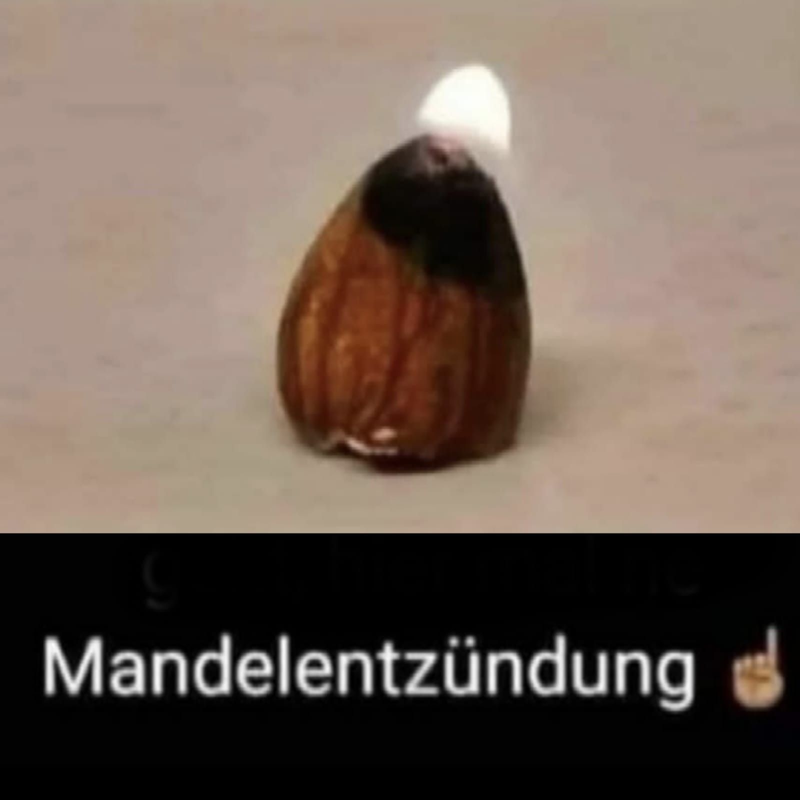 Mandelentzündung d