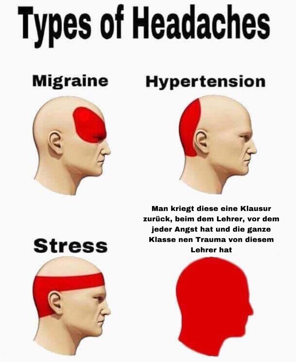 Types of Headaches
Migraine Hypertension
Stress
Man kriegt diese eine Klausur
zurück, beim dem Lehrer, vor dem
jeder Angst hat und die ganze
Klasse nen Trauma von diesem
Lehrer hat